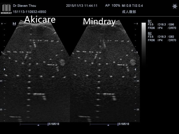 Akicare and Mindray on C5 2 1