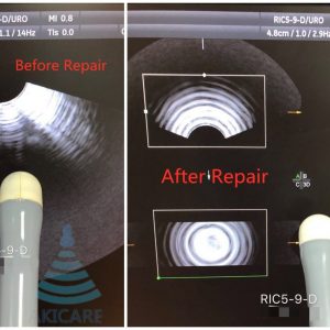 RIC5-9-D For GE LOGIQ E9 3D/4D Endocavitary Transducer Ultrasonido Ultrasonic Sensor Ultrasound Probe REPAIR SERVICE Akicare
