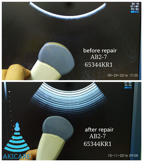 RIC5-9-D Reasonable Ultrasound Price 3D Linear Ultrasound Probe Repair For Voluson E8/E6 Akicare