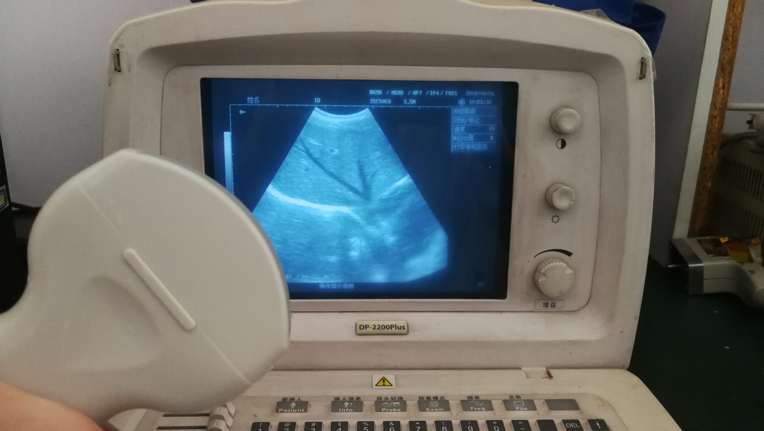 Mindray 35C50EB Probe for Abdominal