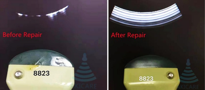 BK 8670 ultrasound probe for Abdomen