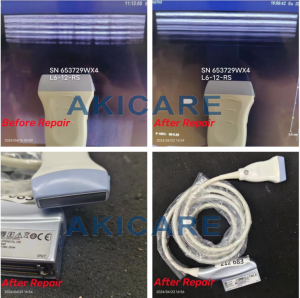 Alpinion L3-12/L3-12T/L3-12i/L3-12H ultrasound probe