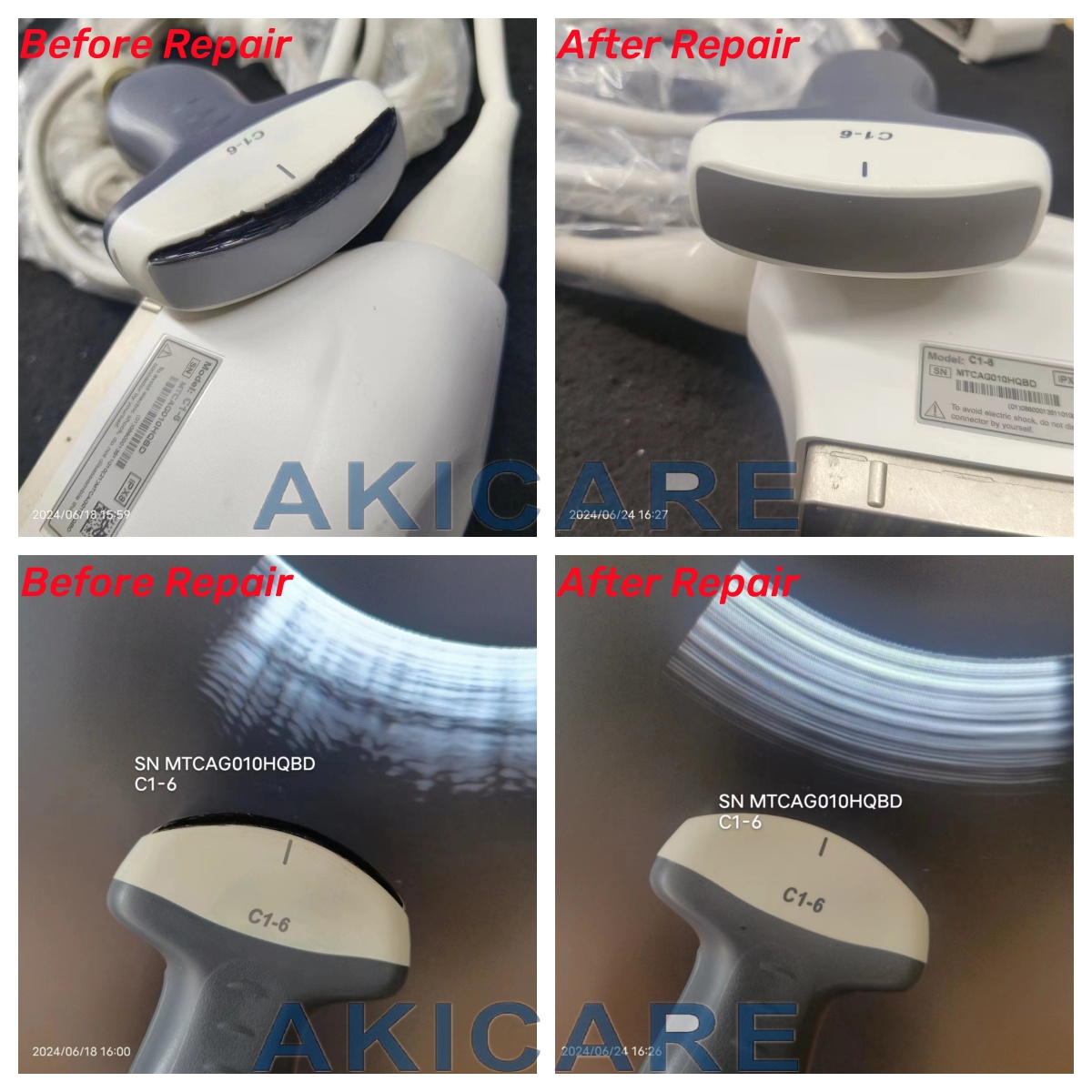 Alpinion SC1-4H/C1-6/C1-6T/C1-6i/C1-6CT/SC1-6/SC1-6H probe for Abdomen
