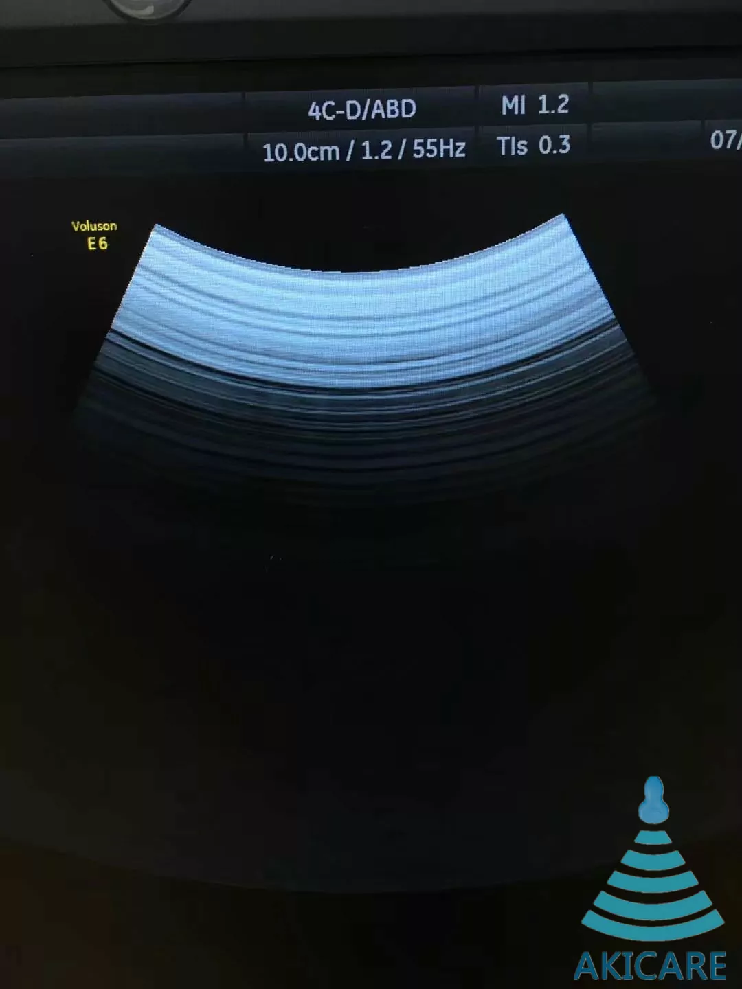 1664-media-1665.webp GE 4C-D ultrasound probe - representative image