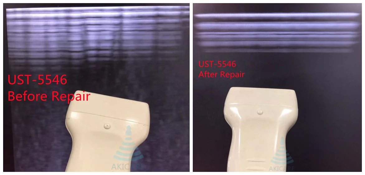 1962-media-1963.webp Hitachi Aloka UST-9124 ultrasound probe - representative image
