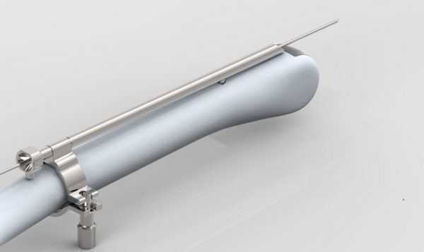 Sonosite-ICT腔内探头穿刺架.jpg Sonosite ICT Biopsy Needle Guide - representative image