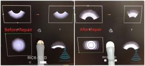 GE RIC6-12-D ultrasound probe - representative image