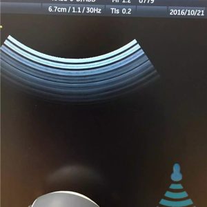 GE RAB2-5-D ultrasound probe - representative image