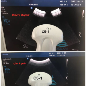主图3-4-1.png Akicare C5-1 ultrasound probe - representative image