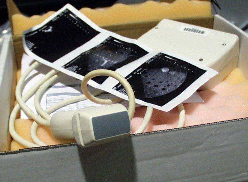 Philips P4-1 Ultrasound Probe Repair 1 philips p4-1 probe repair Philips P4-1 ultrasound probe - representative image